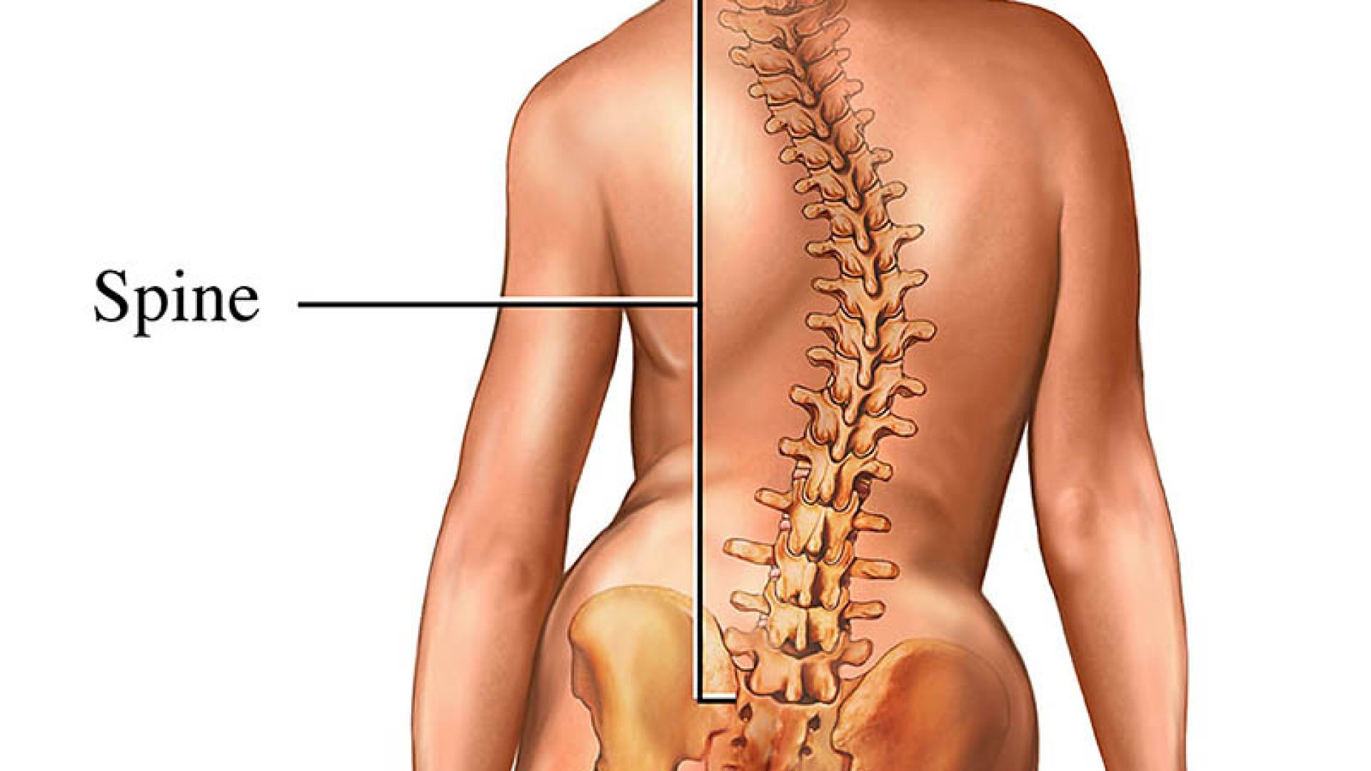 Chiropractor - A solution for Scoliosis